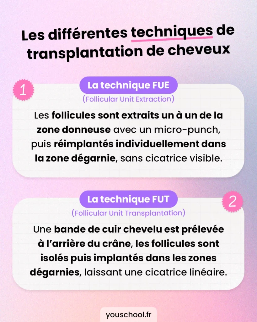 Les 4 techniques reconnues pour la greffe de cheveux