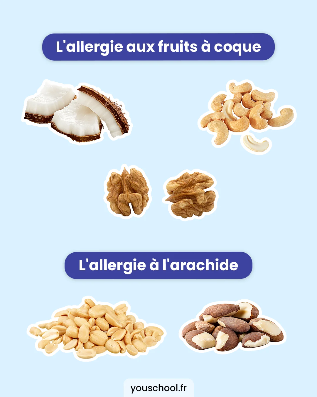 Les trois grands types d'allergies alimentaires : lait de vache, fruits à coque et arachide.