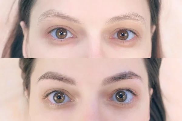 Teinture des sourcils avant après